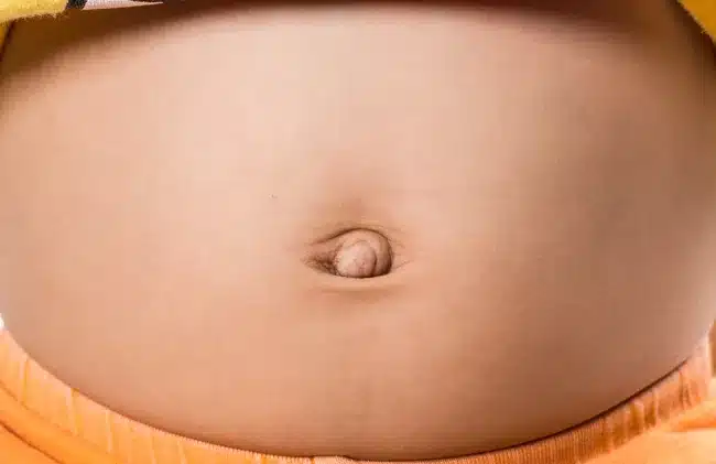 Illustration d'un nombril peu profond, symbole de générosité