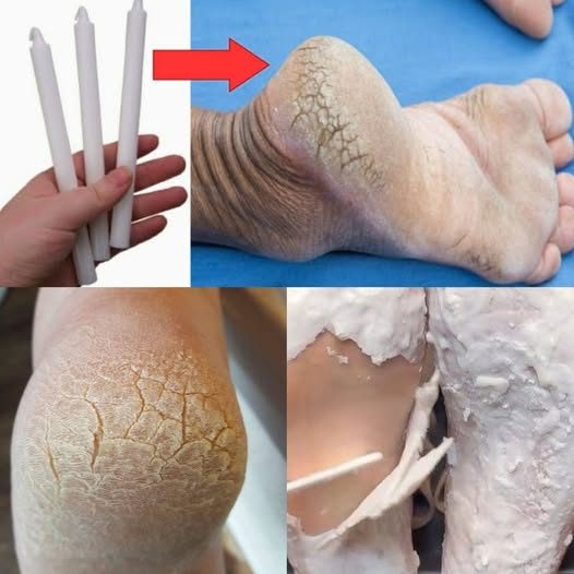 Close-up sur des pieds doux et bien hydratés