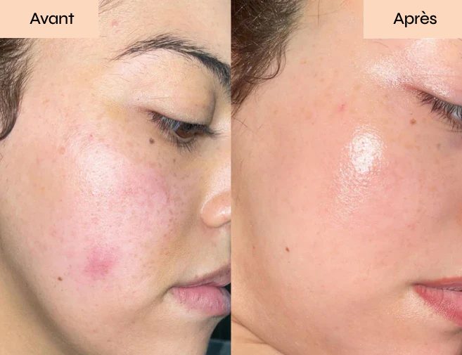 Application d'un soin visage maison