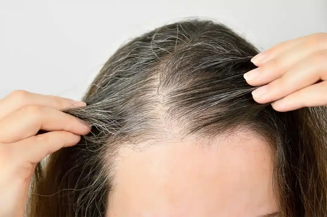 Cheveux grisonnants