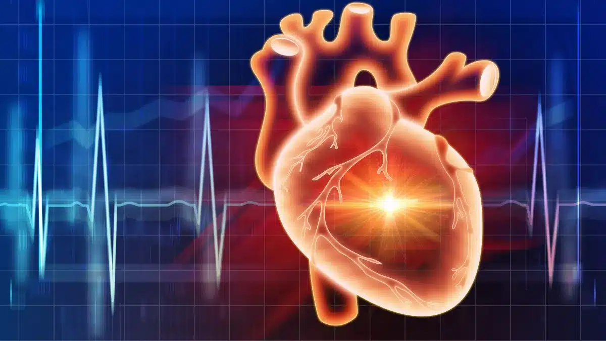 Palpitations cardiaques