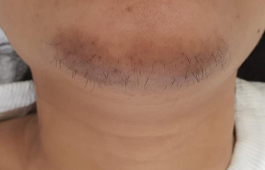 Femme examinant sa pilosité faciale