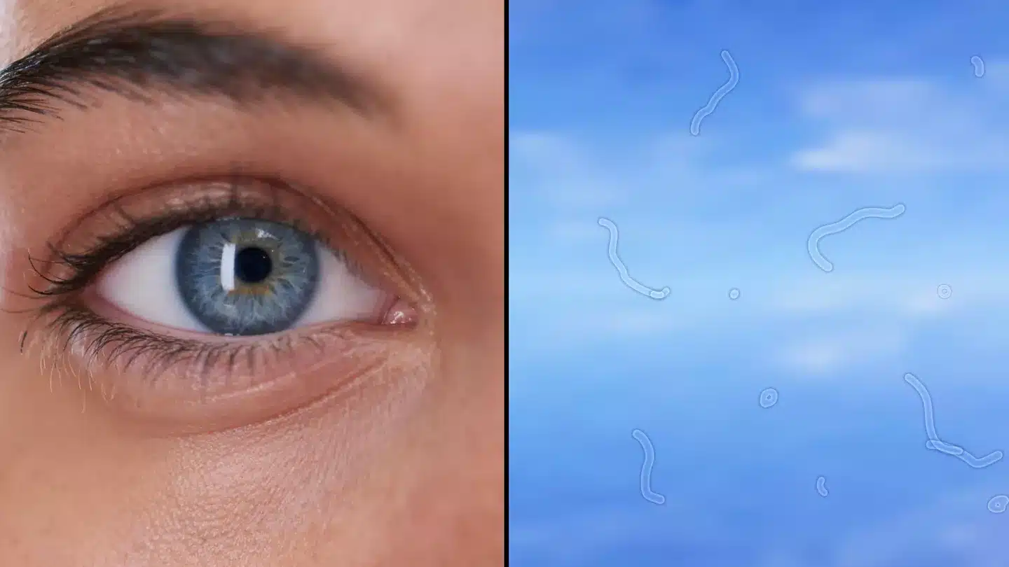 Illustration des corps flottants dans l'œil