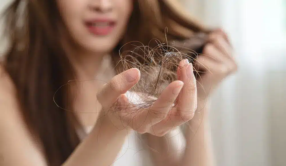 Perte de cheveux liée à des carences